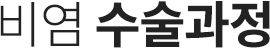비염수술 과정